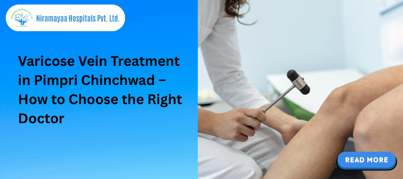 Varicose Vein Treatment in Pimpri Chinchwad – How to Choose the Right Doctor